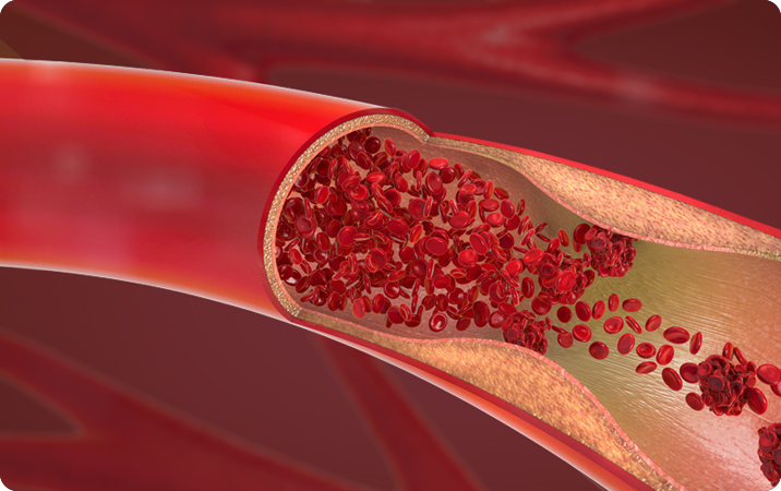 Cardiovascular Health